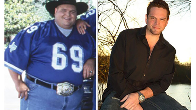 Ron-Lester-before-and-after-weight-loss-surgery.jpg