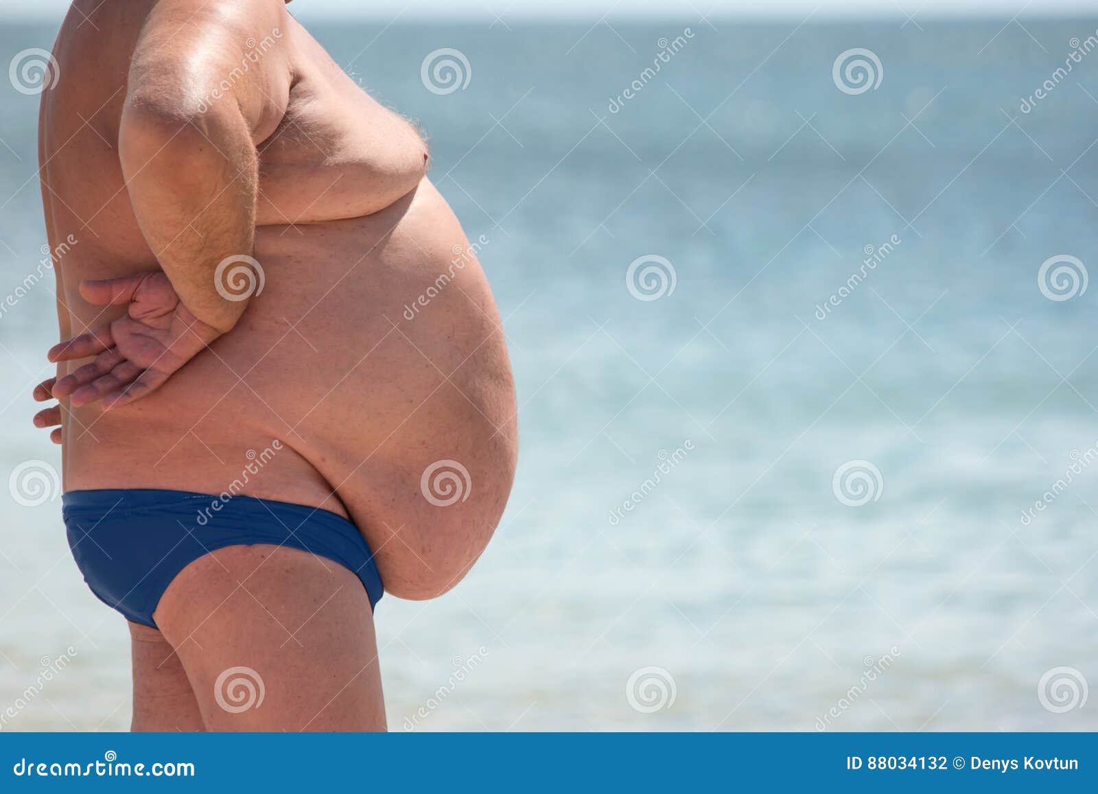 side-view-obese-guy-overweight-man-outdoor-poor-nutrition-sedentary-lifestyle-increased-risk-heart-illnesses-88034132.jpg